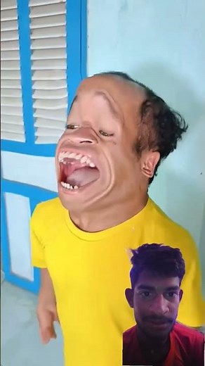 the pain 🤕#youtubeshorts #comedy #subscribe #likeandsubscribe