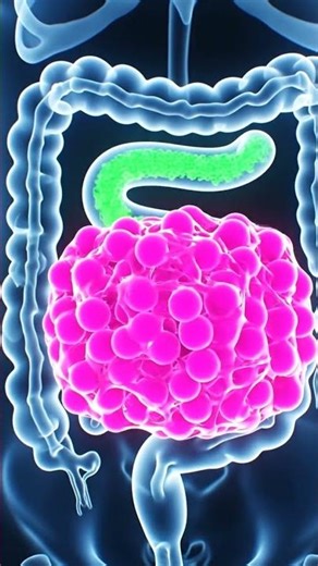 POV: Does Gum REALLY Stay In Your Stomach For 7 Years? 🍬🛑 (X-Ray)