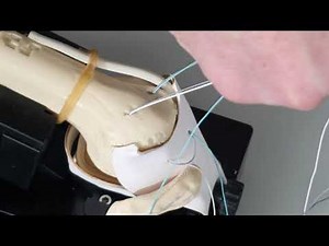 GT-Tunneler Technique | U-configuration with Dexter Surgical Training Model