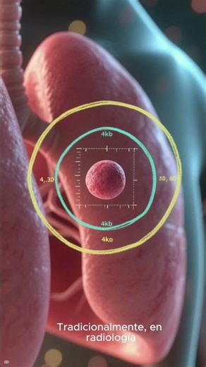 ITK SNAP RADIOLOGIA #inteligenciaartificial