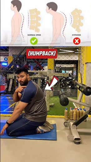 🥇 Fix Your Hunchback FAST! 🔥 Best Posture Correction Exercise You Need