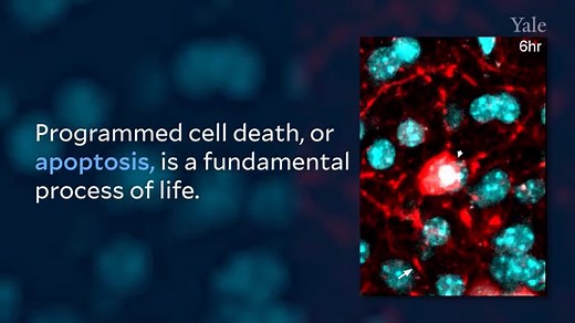 Researchers Share First Captured Image of Dying Neuron