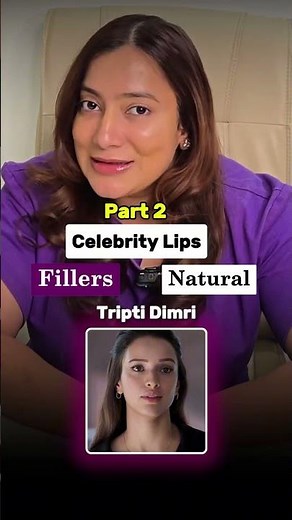 Back with another round of rating celebrity lips natural vs enhanced 👀