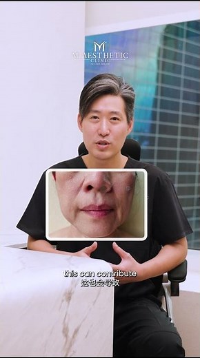 Why do sunken cheeks occur and can they be treated?