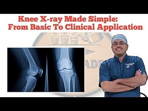 Knee X-ray Made Simple: From Basic To Clinical Application