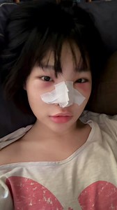 Bonnie nose surgery လုပ်လိုက်ပါပြီ 🫶🏻 Grand Plastic Surgery Service Myanmar | Bonnie - ဘွန်နီ