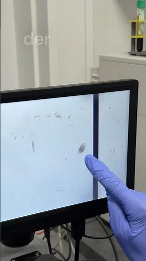 Where do worms come from in horses? 😯 #diehofwg #veterinarymedicine