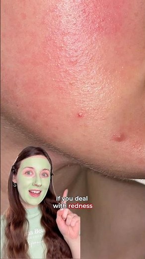 Skintific Mugwort Anti Pores & Acne Clay Stick ✅