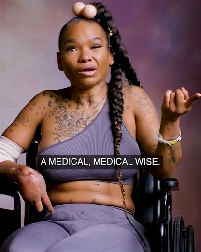 One Day Changed Everything: Apple's Story. | Soft White Underbelly