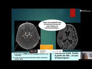 Stroke course Dr. D. BADSI