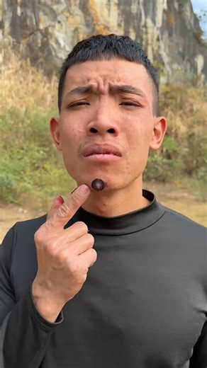 Beard Spot Trouble 😂🧔😁😆😁