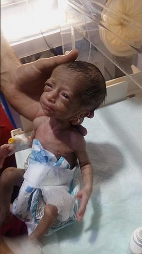 LBW Baby Journey in NICU Recovery & Support #cute #baby #newborn #neonatologist #babycare