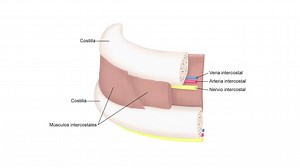 Cómo hacer una toracostomía con tubo y catéter - Neumología - Manual MSD versión para profesionales