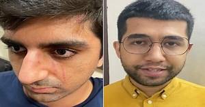 How To Care For, And Protect, Stray Animals In India