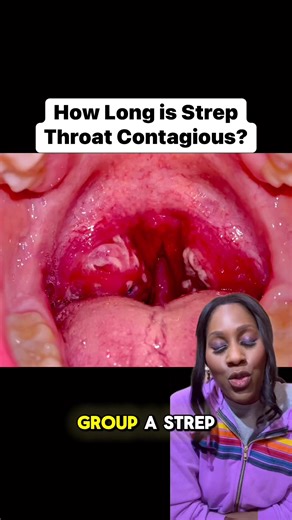 How long is strep throat contagious! #strep #strepthroat #Streptococcus #sorethroat | Dr. Jen Caudle