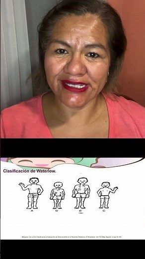 ¡Descubre cómo se clasifica la desnutrición y por qué es importante conocer sus diferencias! 🍎🥦