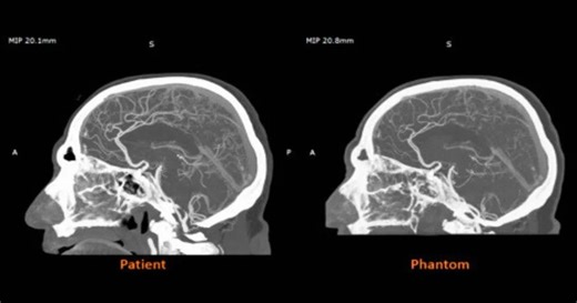 Stratasys Launches 3D Printing Material for Medical Imaging