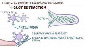Video: Clot retraction and fibrinolysis - Video Explanation! | Osmosis | Osmosis