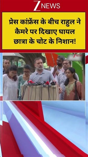 Rahul Gandhi New PC: प्रेस कांफ्रेंस के बीच राहुल ने कैमरे पर दिखाए घायल छात्रा के चोट के निशान!