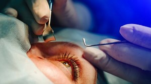 Confusion In Selecting The Right Lens After Cataract Surgery? Expert Lists Tips That Can Help