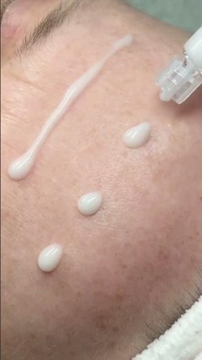 Why Spicules Make Your Skincare Work Better