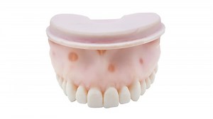 TrueJaw W/ Calcified Canal - PlanB Dental