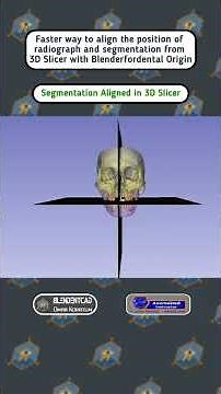 Faster alignment of 3D Slicer segmentation & radiograph with blenderfordental origin