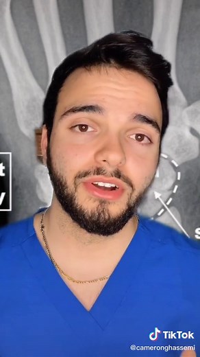 Discovering the Anatomical Snuffbox: What You Need to Know