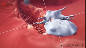 3.2K views · 40 reactions | Platelet Activation and Factors for Clot Formation | PakMed - CME | Facebook