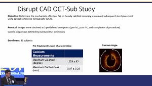 Shockwave Therapy for Calcified Coronary Artery Disease