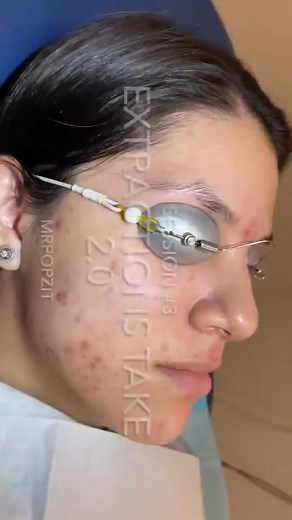 Part 2 : https://emmeacne.com/?p=3958 | PopZit Family