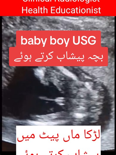 Understanding Baby Boy Ultrasound Results