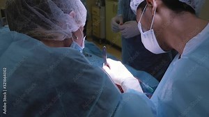 A group of surgeons performs a facelift operation. Ear scalpel incision 4.