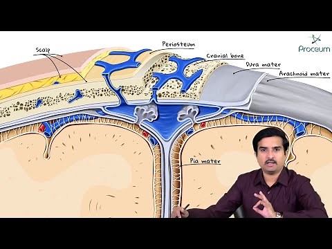 Epidural Hematoma (Epidural hemorrhage): Etiology, Clinical features, Diagnosis and Treatment