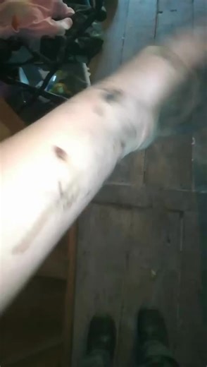 Cleaning Dirty Stained Arms: Effective Tips