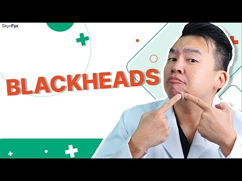 Removing Blackheads: Best & Worst Ways