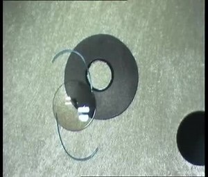 Implantation of a Combined Iris Prosthesis and IOL through a 2.4 mm Incision - Eyetube