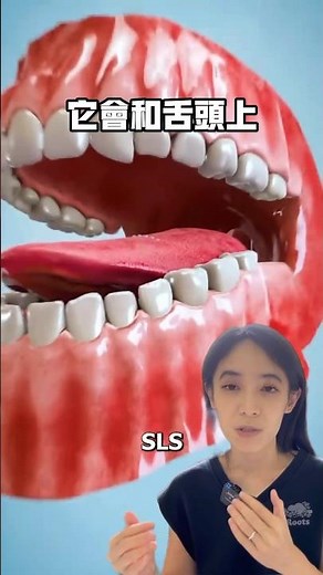 牙膏中的這種成分可能造成嘴巴破皮😨？#口腔潰瘍#舌頭