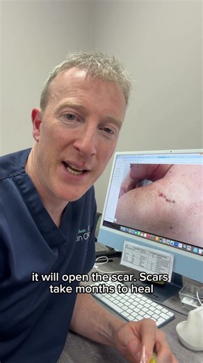 The sellotape trip to reduce back scars from widening