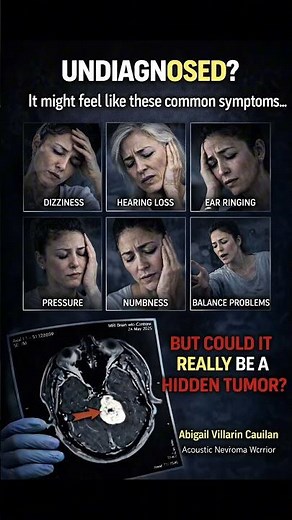 Acoustic Neuroma Series 2 #acousticneuroma #healthawareness #vestibularschwannoma