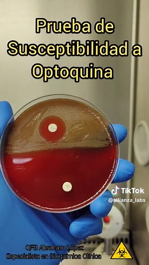 Prueba de Optoquina para Identificar Streptococcus pneumoniae