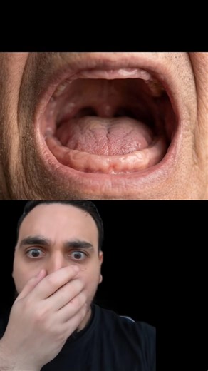 Born With NO Teeth: Anodontia | Dentist Reacts #oralhealth