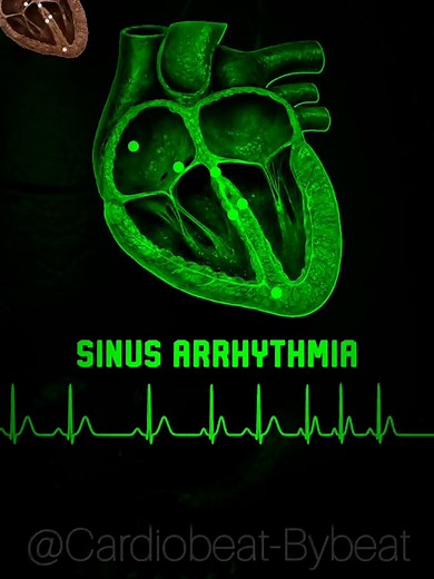 ECG Rhythm Visual Guide: Sinus Rhythm, Sinus Arrhythmia & Tachycardia