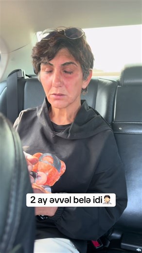 Sən çox şəkərsən kız ❤️ @Saglam-Addım-Rehab