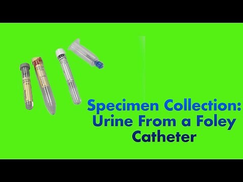 Specimen Collection: Urine from a Foley Catheter