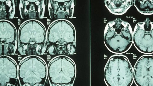 Study shows how thumbs helped shape the brain