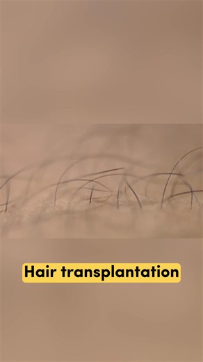 Learn more about Hair Restoration | The Radar
