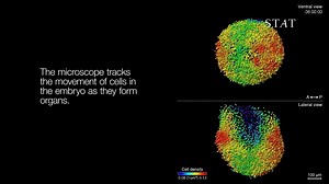 7.4K views · 45 reactions | This “laser light sheet microscope” can peer inside living mouse embryos, capturing the first-ever real-time images of organ development inside a mammal. https://buff.ly/2pObtGp | STAT | Facebook
