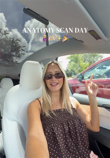20-Week Anatomy Scan: What to Expect During Your Ultrasound