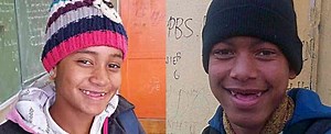 What’s the Deal with Passion Gaps | Tooth Extraction, Gold Teeth, Slavery, Cape Town Flats Smile South Africa